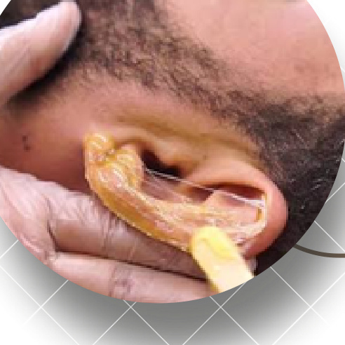 Orelha